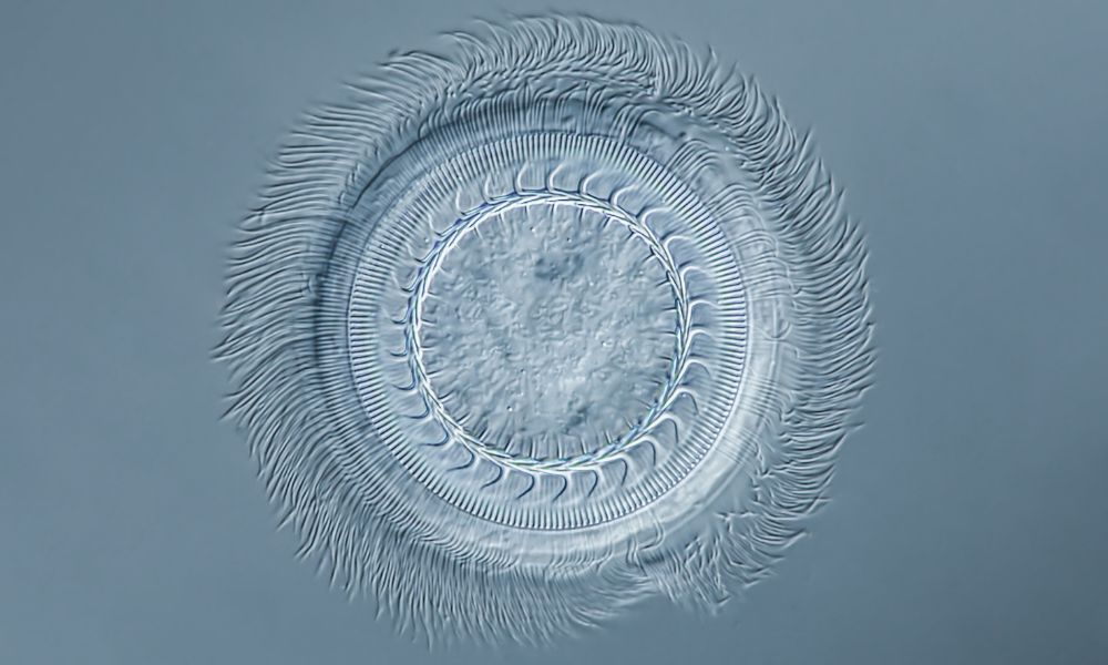 ciliate example